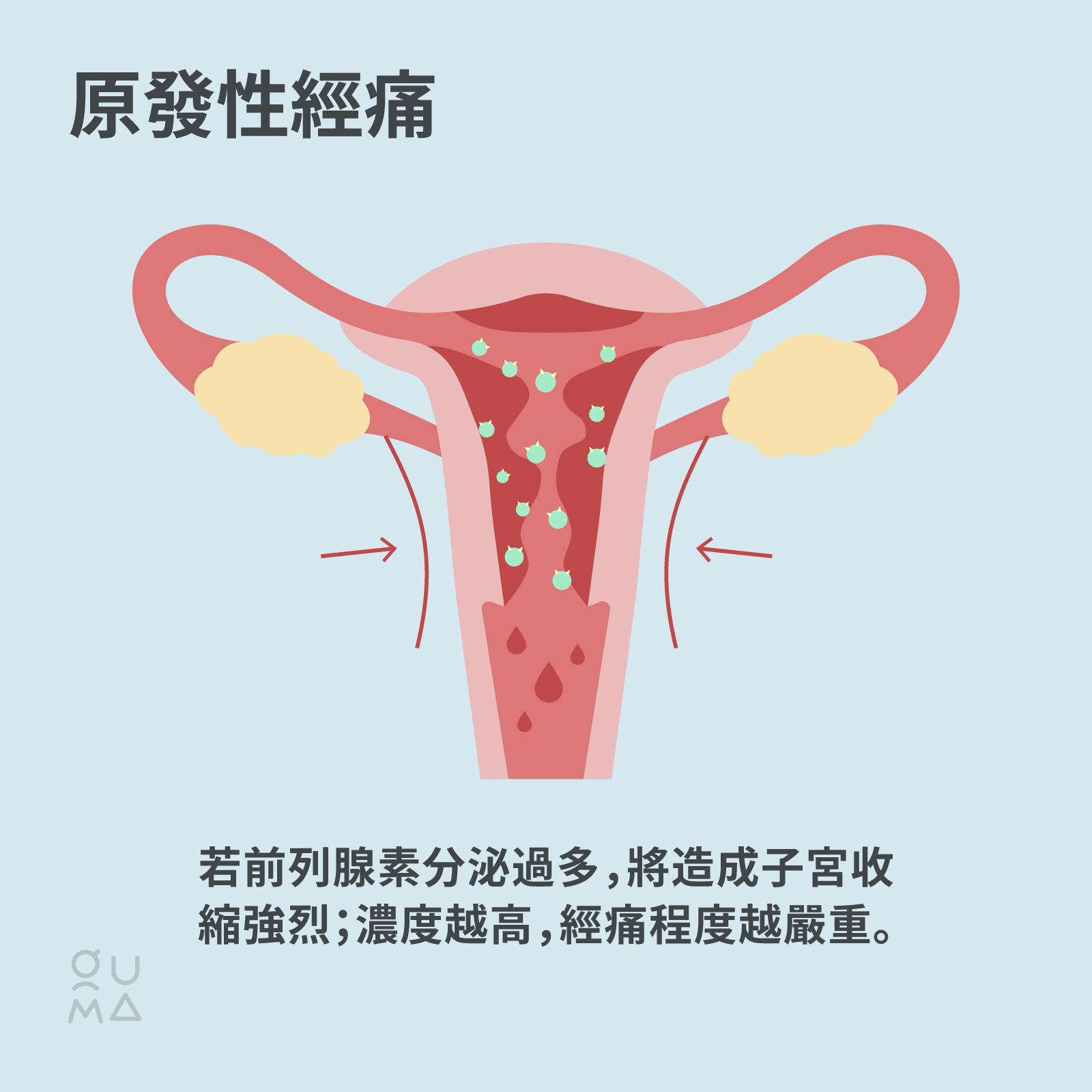 經痛止痛藥該怎麼選?